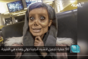 قناة العربية فيديو فتاة قامت بعمل 50 عملية لتشبه انجلينا جولي