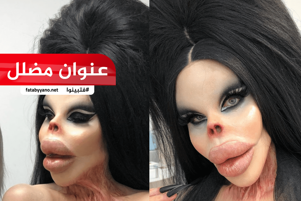 عملية تجميل انتهت بكارثة
