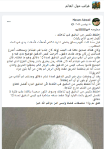 ادعاء كيس الطحين مفيد لعلاج الحروق