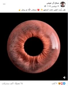 ادعاء فيديو العين البشرية تحت المجهر