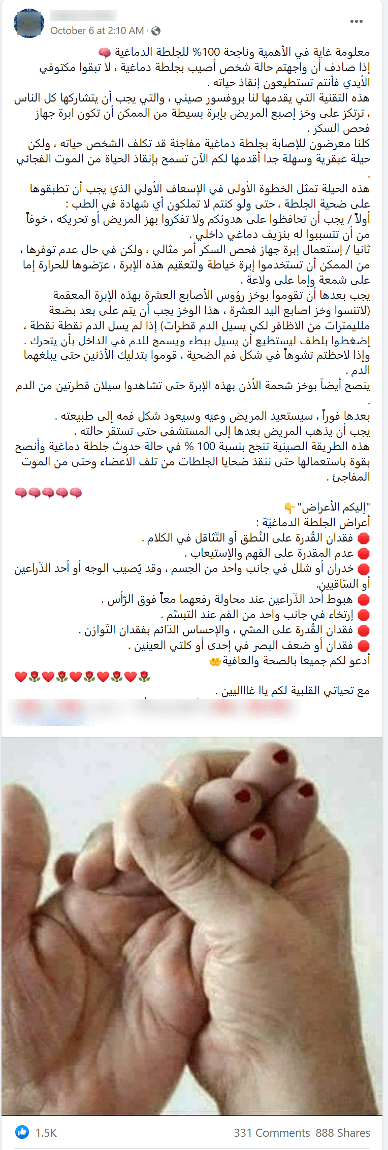ادعاء علاج السكتة